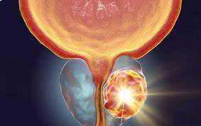 Maintain a Healthy Prostate
